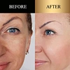 collagen skin care
